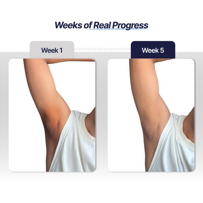 Underarm Roll On for Men