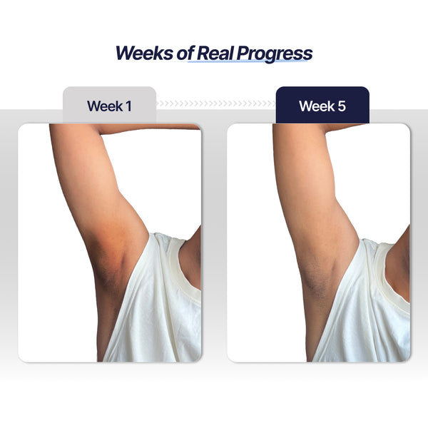 Underarm Roll On for Men